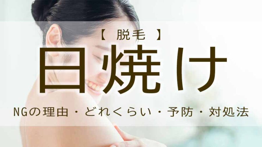 脱毛の日焼けはどのくらいで断られた！？いつからOK？